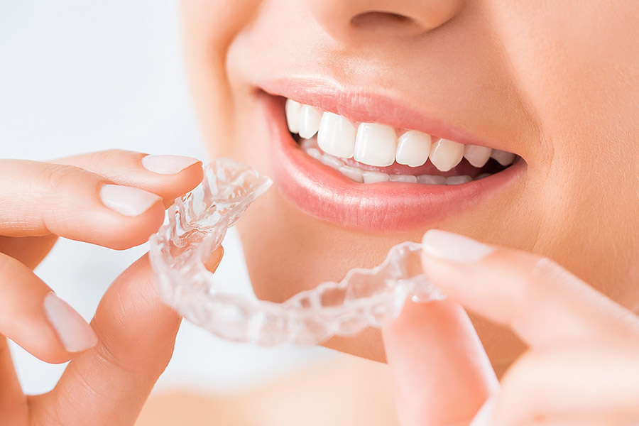 ventajas de usar ortodoncia invisible invisalign